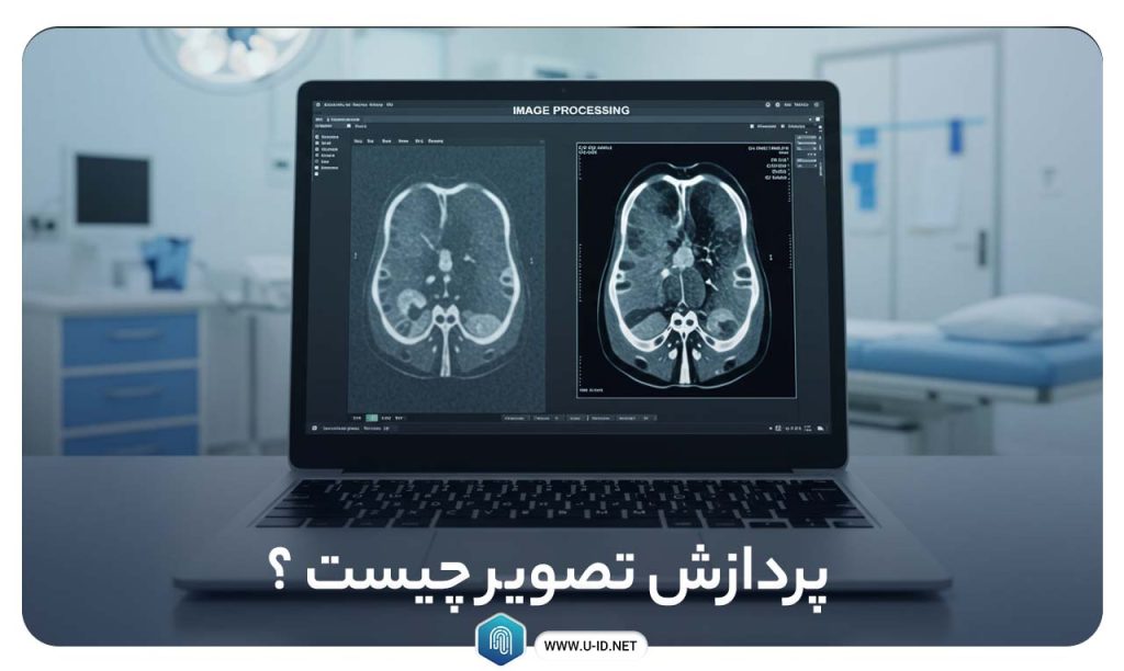 بینایی ماشین و پردازش تصویر؛ تفاوت‌ها و شباهت‌ها